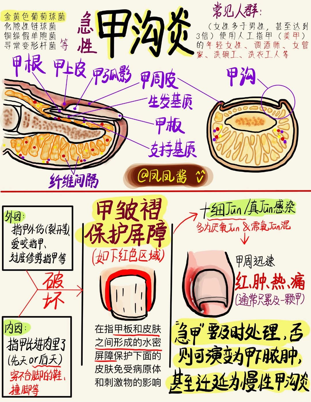 📖 医学生笔记 |急性甲沟炎 建议点赞收藏