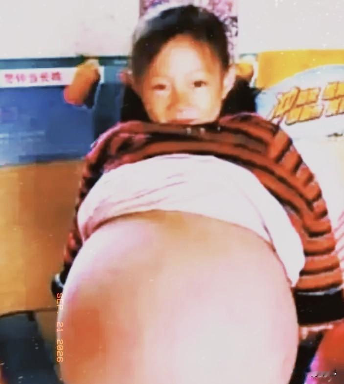 山西一4岁小女孩，肚子异常鼓胀，大得像足月孕妇。多家医生轮番诊断，残酷预言她活不