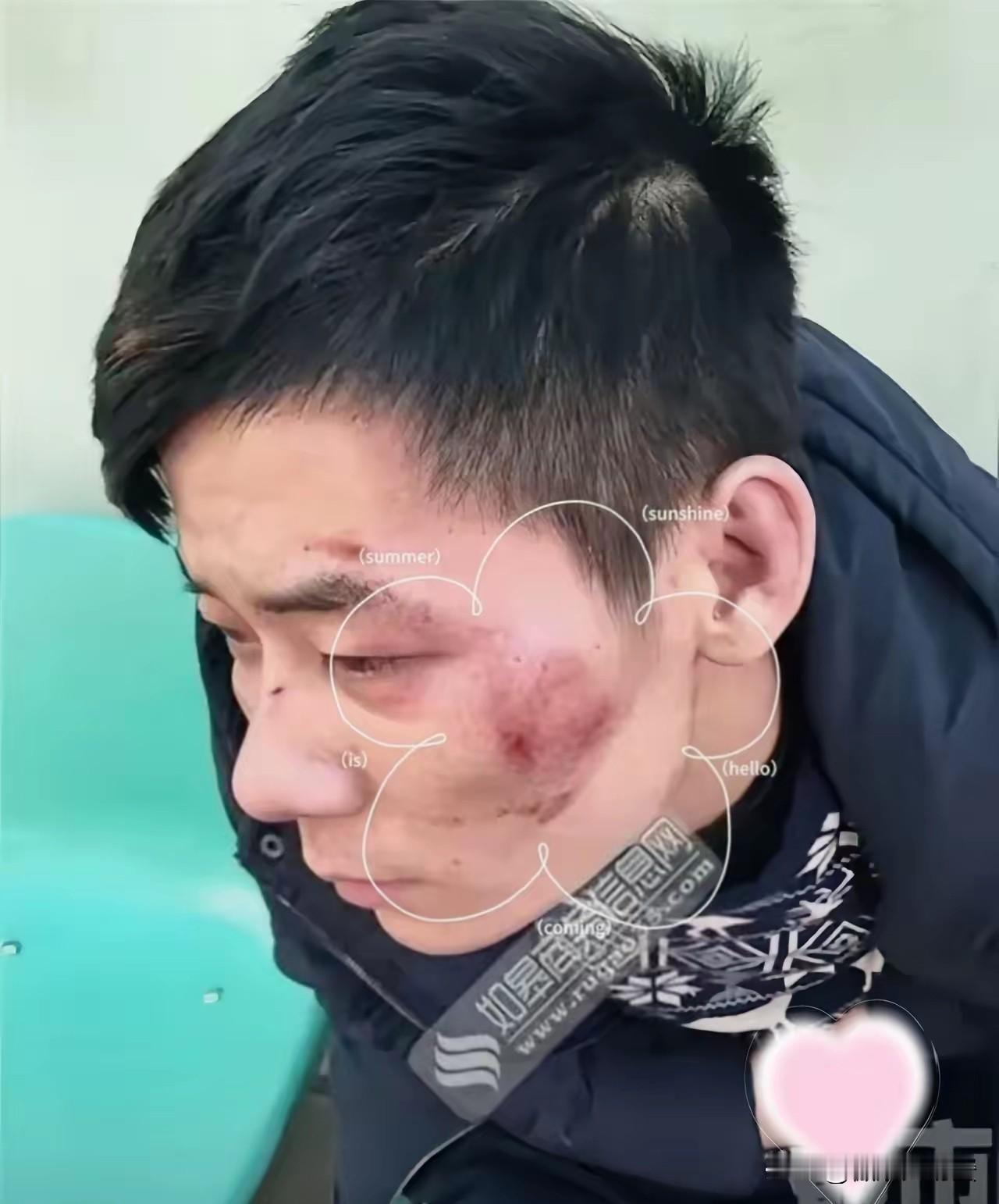半夜被六个壮汉穷追猛打，换作常人早吓破胆了，偏偏这位老哥命悬一线时走出步绝棋！5