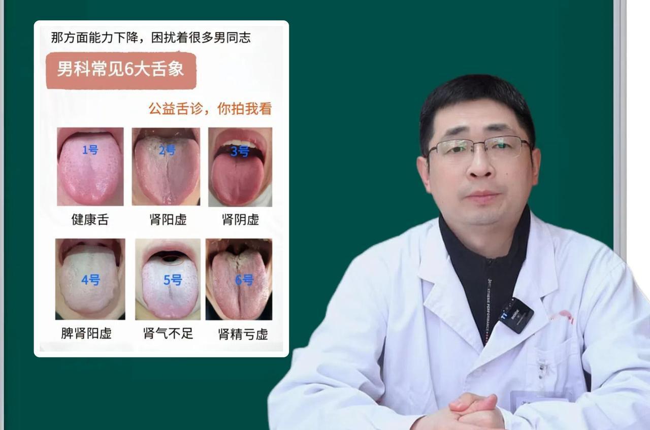 这个月每日坚持抽空看舌象第10天，今天争取看完100个舌象！

你拍我看，从舌象
