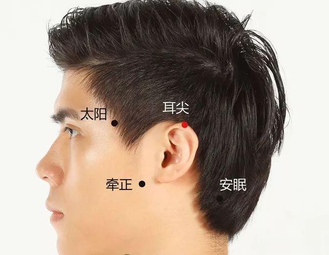 神奇的耳尖放血，高烧退热显奇效！ 【标准定位】在耳郭的上方，当折耳向前，耳郭上方