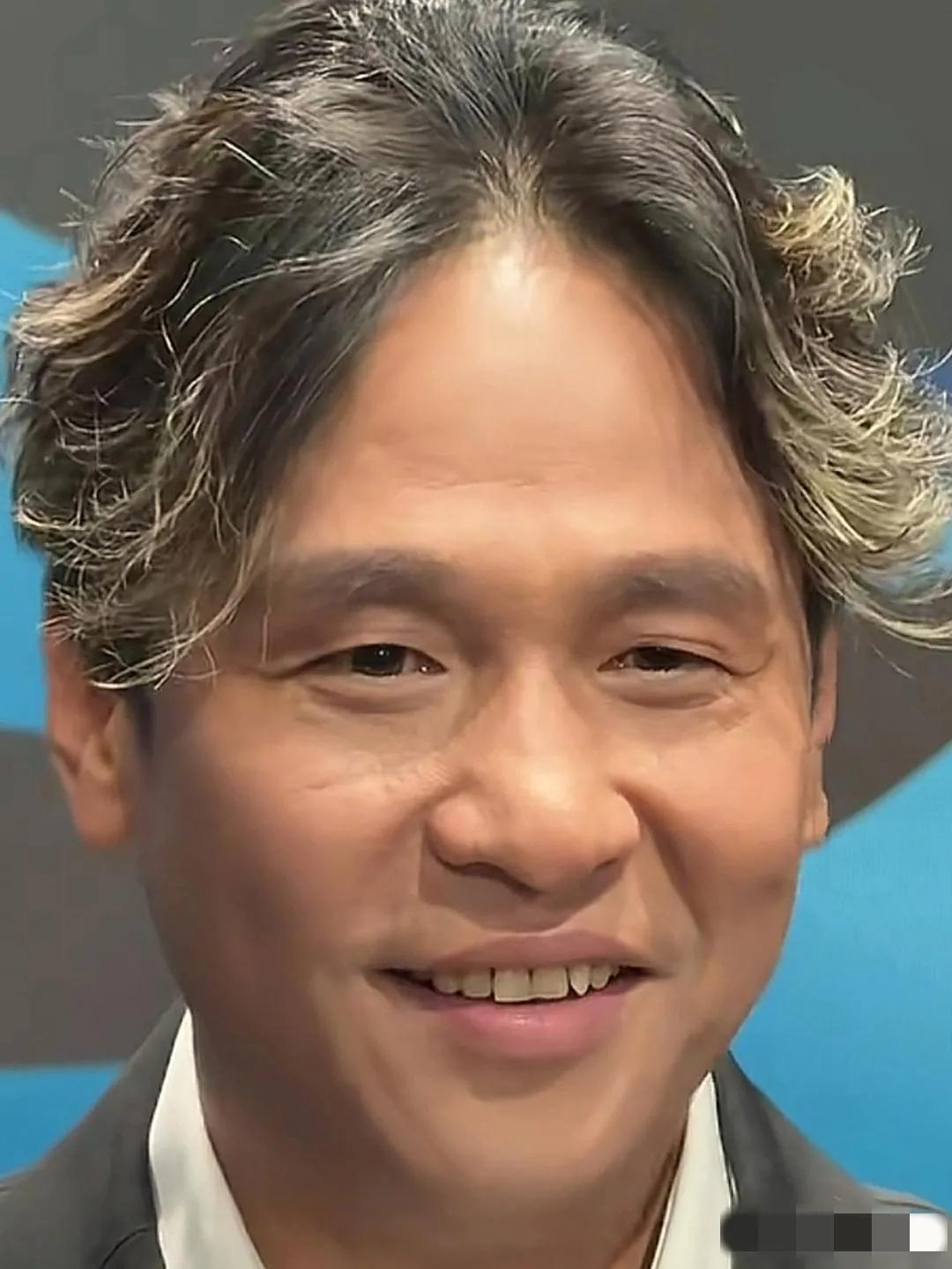 一晃儿宋小宝也老了不少：发际线后移，眼周皱纹深刻，脸型变长，眼角耷拉，鼻大且塌过