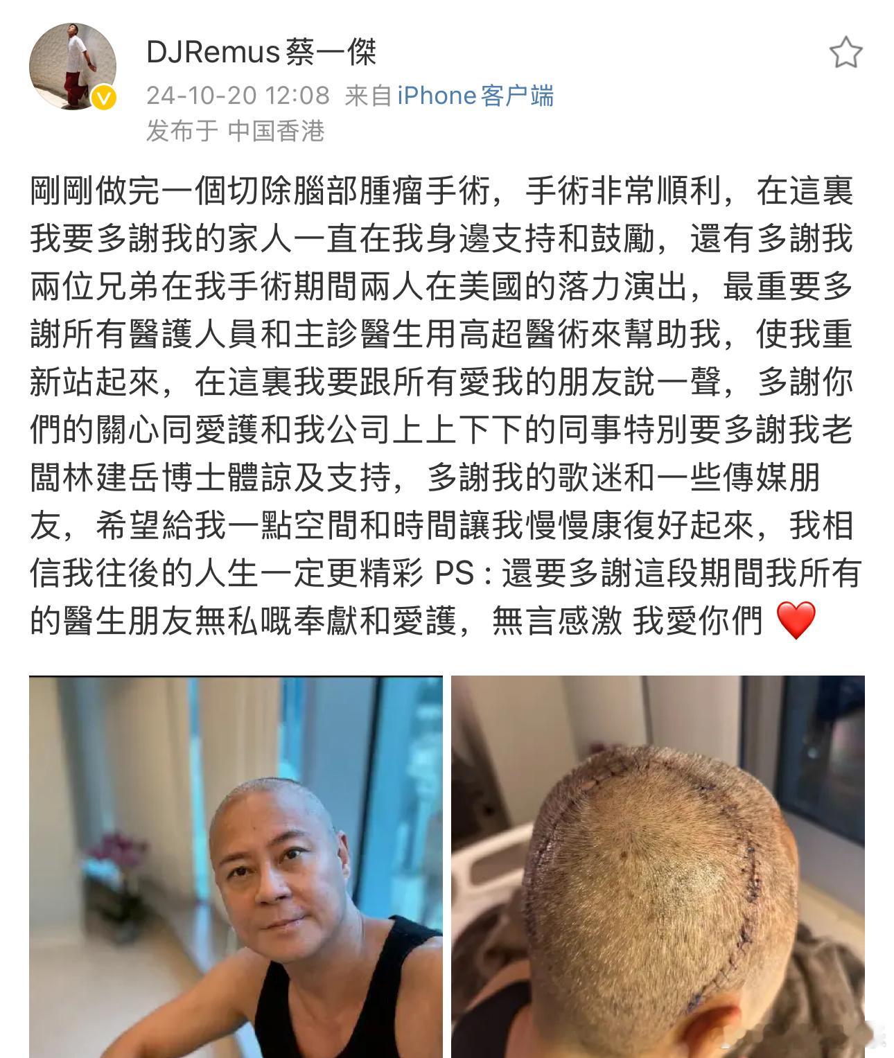 #草蜢蔡一杰做脑瘤手术#20日，蔡一杰晒出照片表示自己做了切除脑部肿瘤手术：“刚