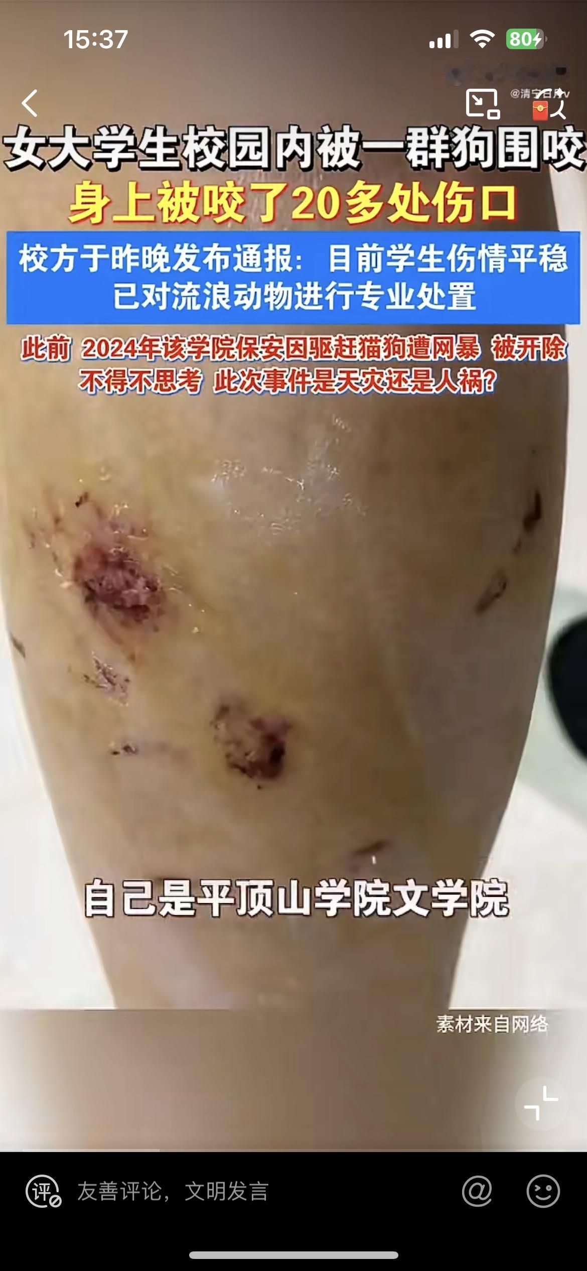 平顶山学院一大三女生校园内遭一群疯狗撕咬，比较讽刺的是，2024 年该校保安打流