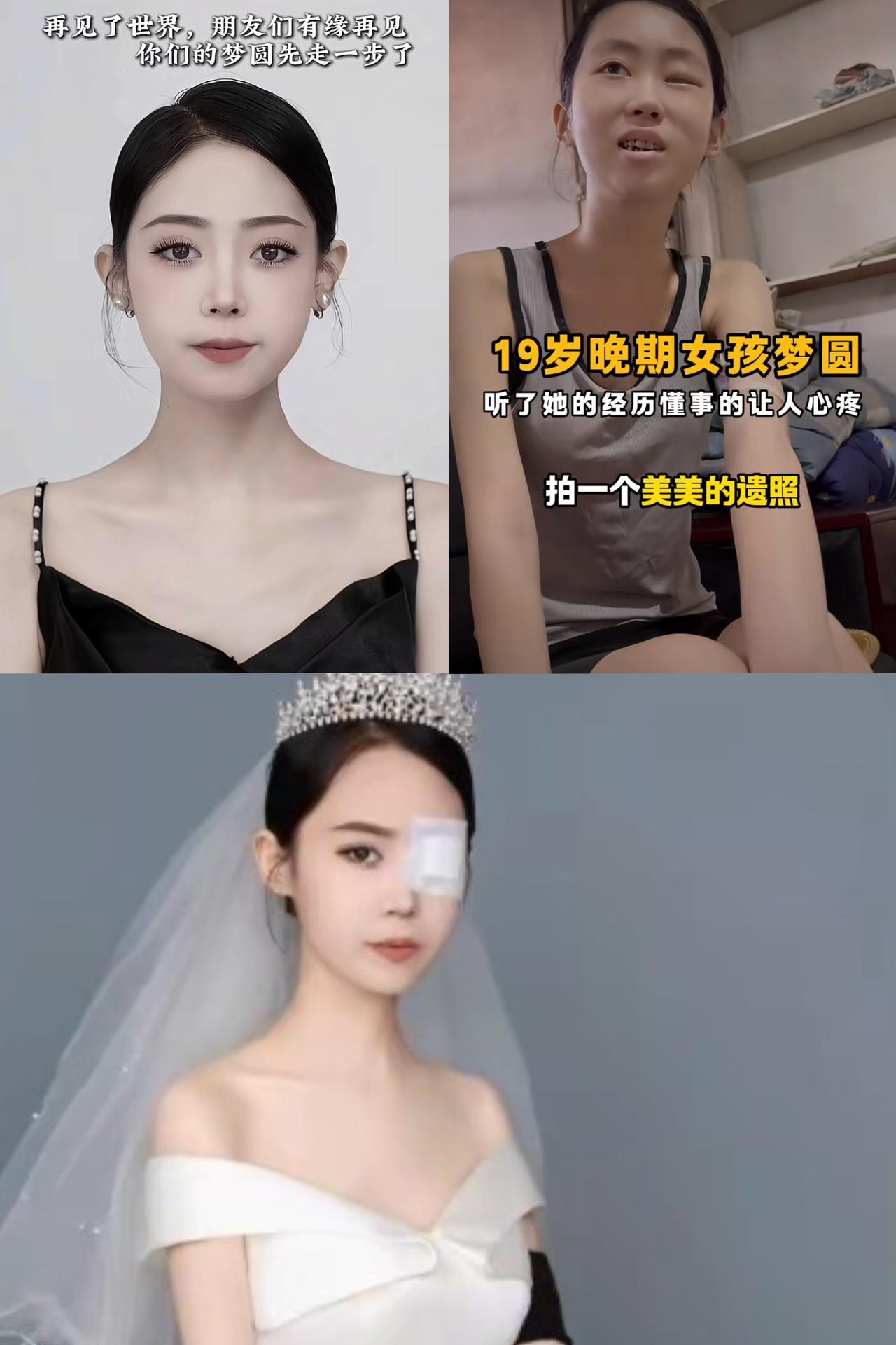 19岁患鼻咽癌的临沂姑娘“梦圆”于8月14日早上离世了，15岁检查出癌症，母亲患