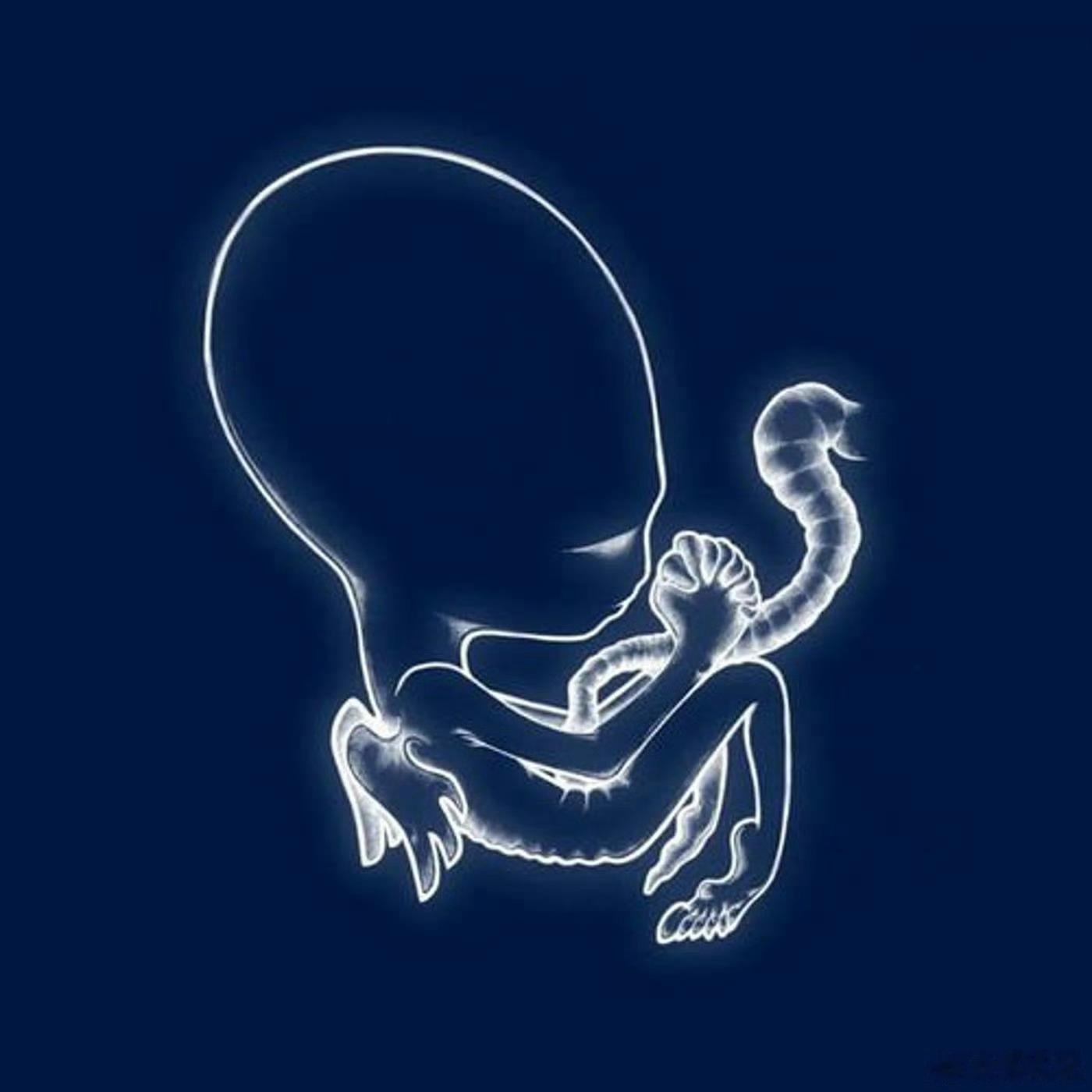 音乐发行回顾 27年前的今天，冰岛后摇团Sigur Rós发行第二张录音室专辑《