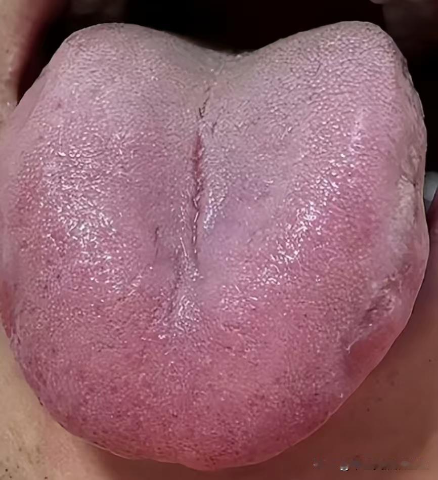 人到中年有两怕，肝郁+脾虚，肾虚也得靠边站

人到中年有两大怕，那就是肝郁加脾虚