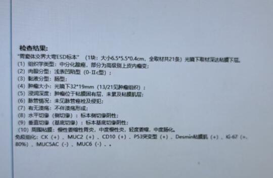 山东来的好消息