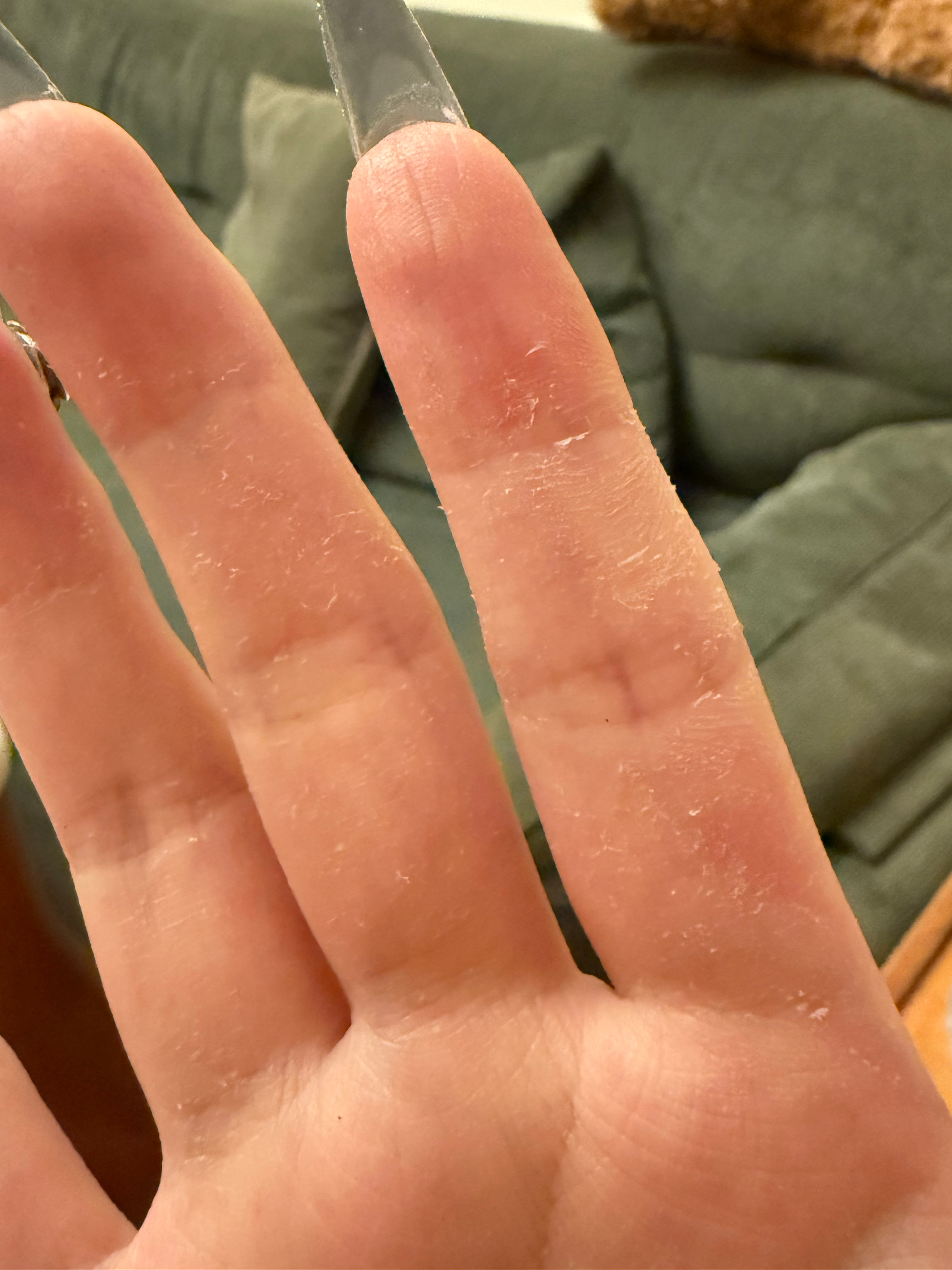 昨天说搞卫生搞了五个多小时把手都洗皱洗脱皮了不是夸张因为是真的脱皮了… 