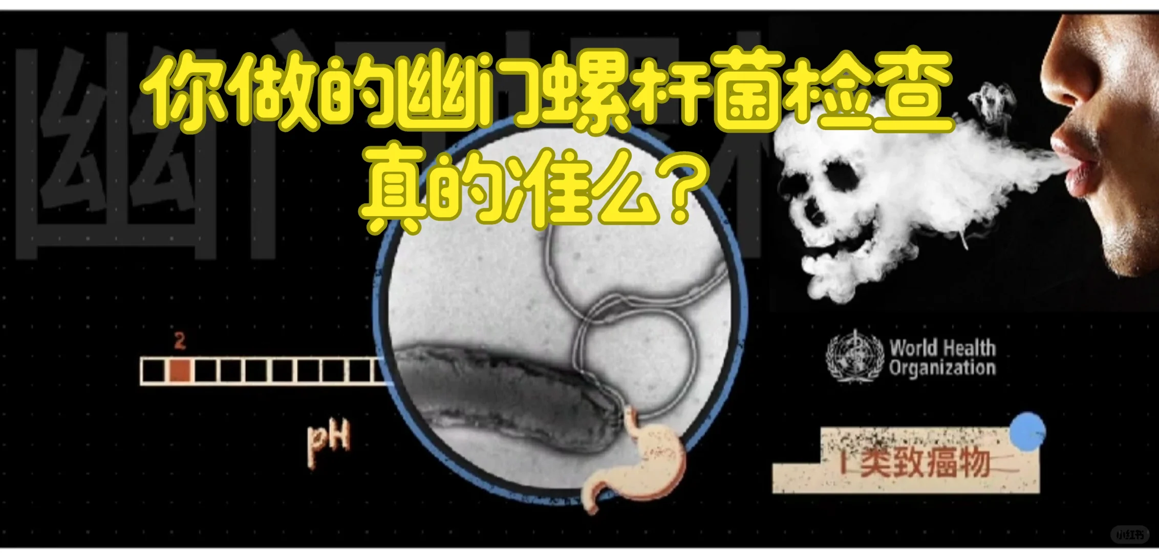 幽门螺杆菌检测阴性，真的就是没有感染么？