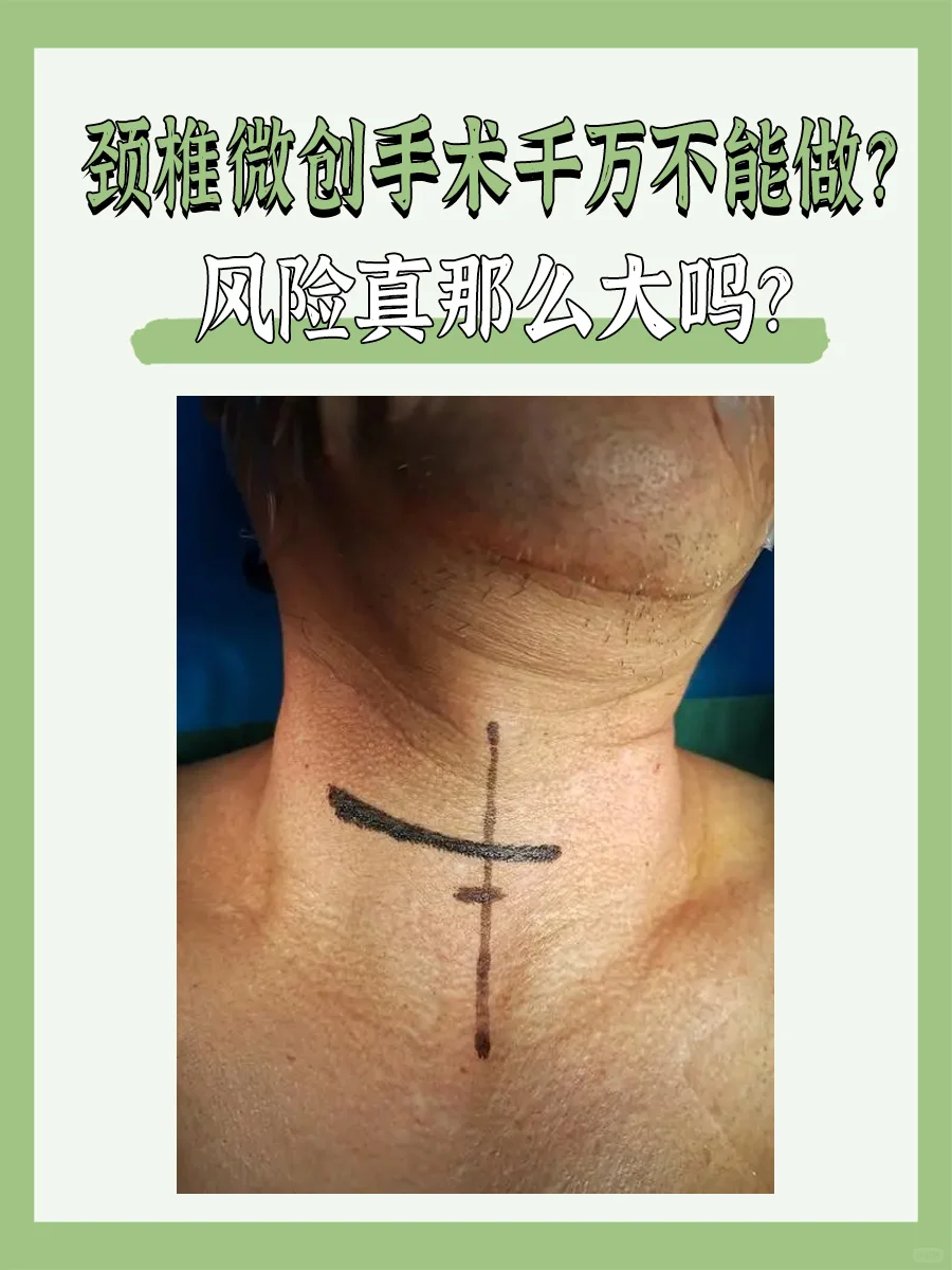 颈椎微创手术风险大吗