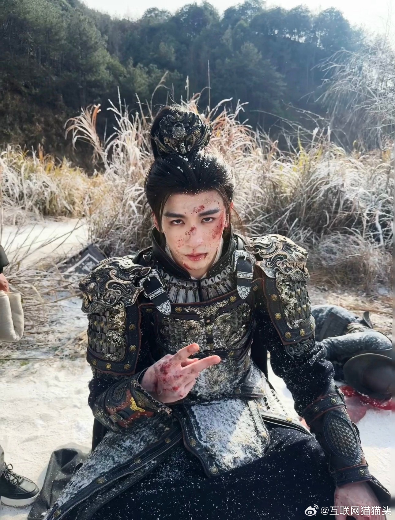 张凌赫晒谢征日常谢征日常：在受伤，刚受伤，又要受伤😬张凌赫本人在线吐槽，破碎感