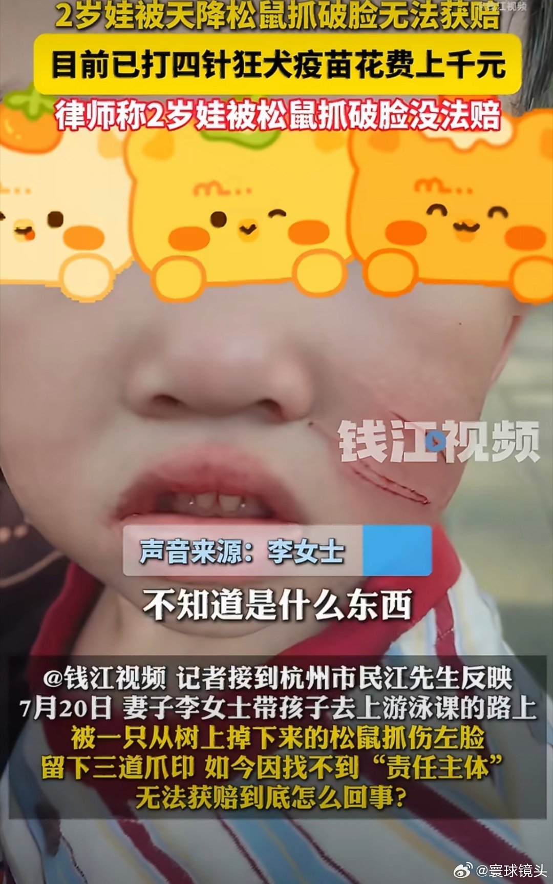 2岁娃被天降松鼠抓破脸无法获赔两岁的孩子被松鼠抓伤，是属于意外风险，要是孩子有意