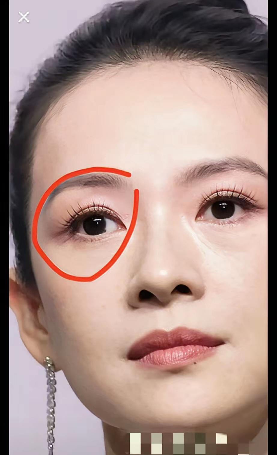 女明星眼睛里的黑点怎么回事？