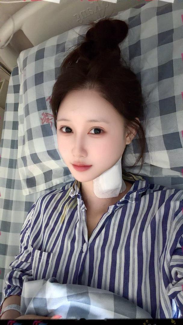 一忙完工作就来住院了 2026.7.7做第三次手术 很顺利而且状态比年前好很多 