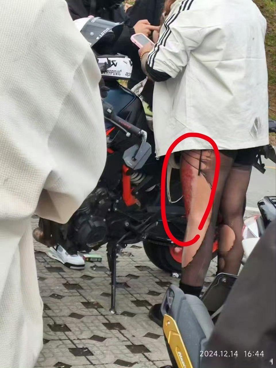 骑行女网红，这摔得不轻啊？[黑线] 