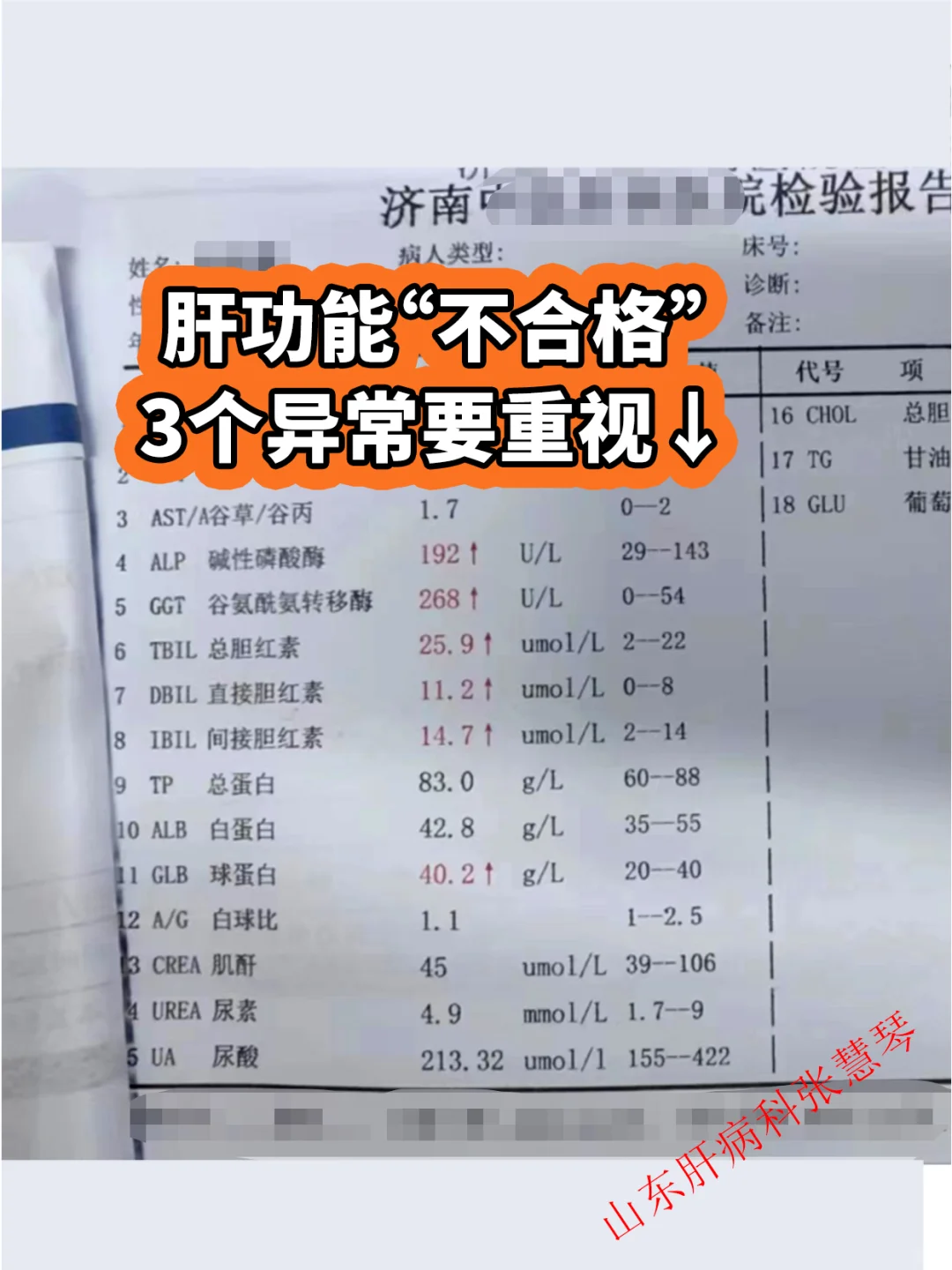 肝功能检查“不合格”这3个异常要重视↓