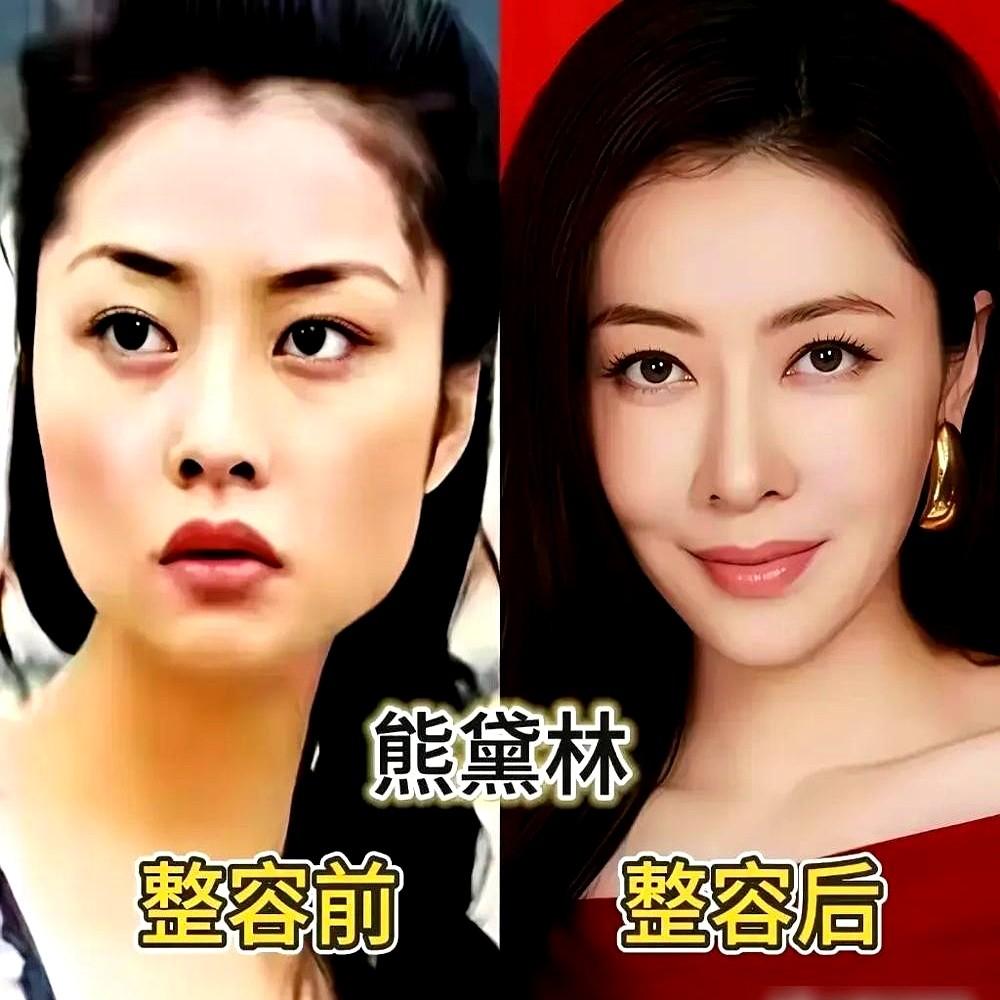 沈梦辰早年选秀的照片被翻出来，跟现在的脸放在一起，根本不像一个人。

以前圆脸、