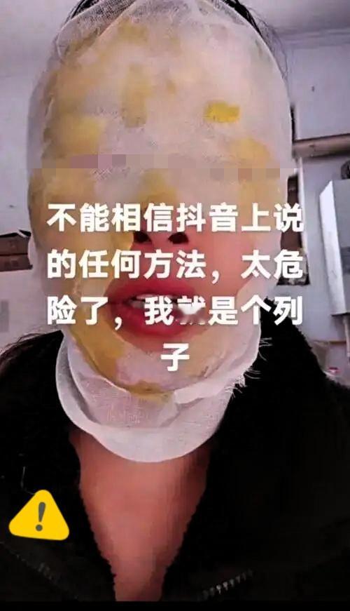邯郸一女子模仿网络“妙招”，白糖加白醋烧开除水垢，被沸水烫伤面部

水垢难除？河