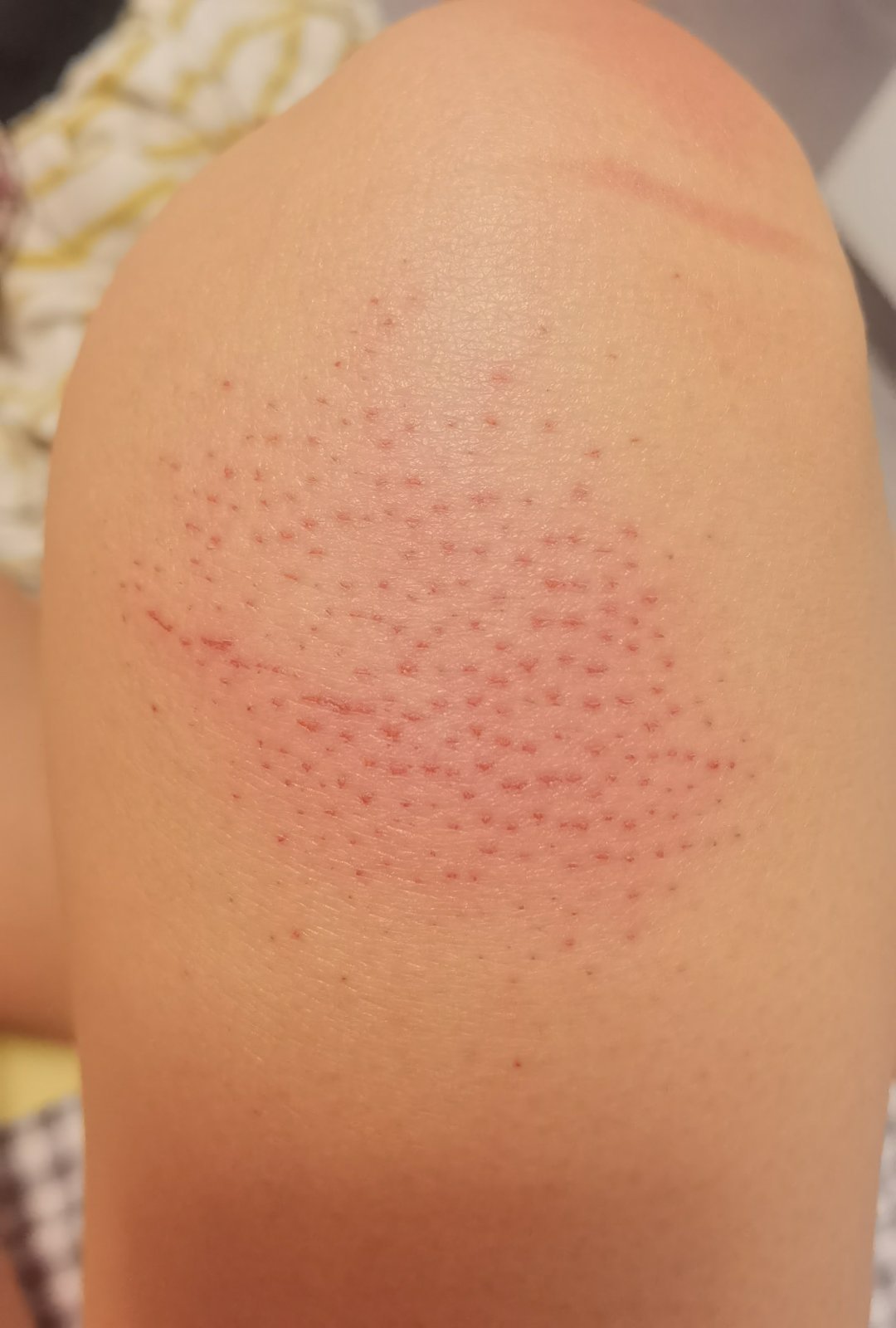 一天一宿了，这个腿还是这个样子，想着哪个行业都不容易，不想让搓澡大姐失业，可是我