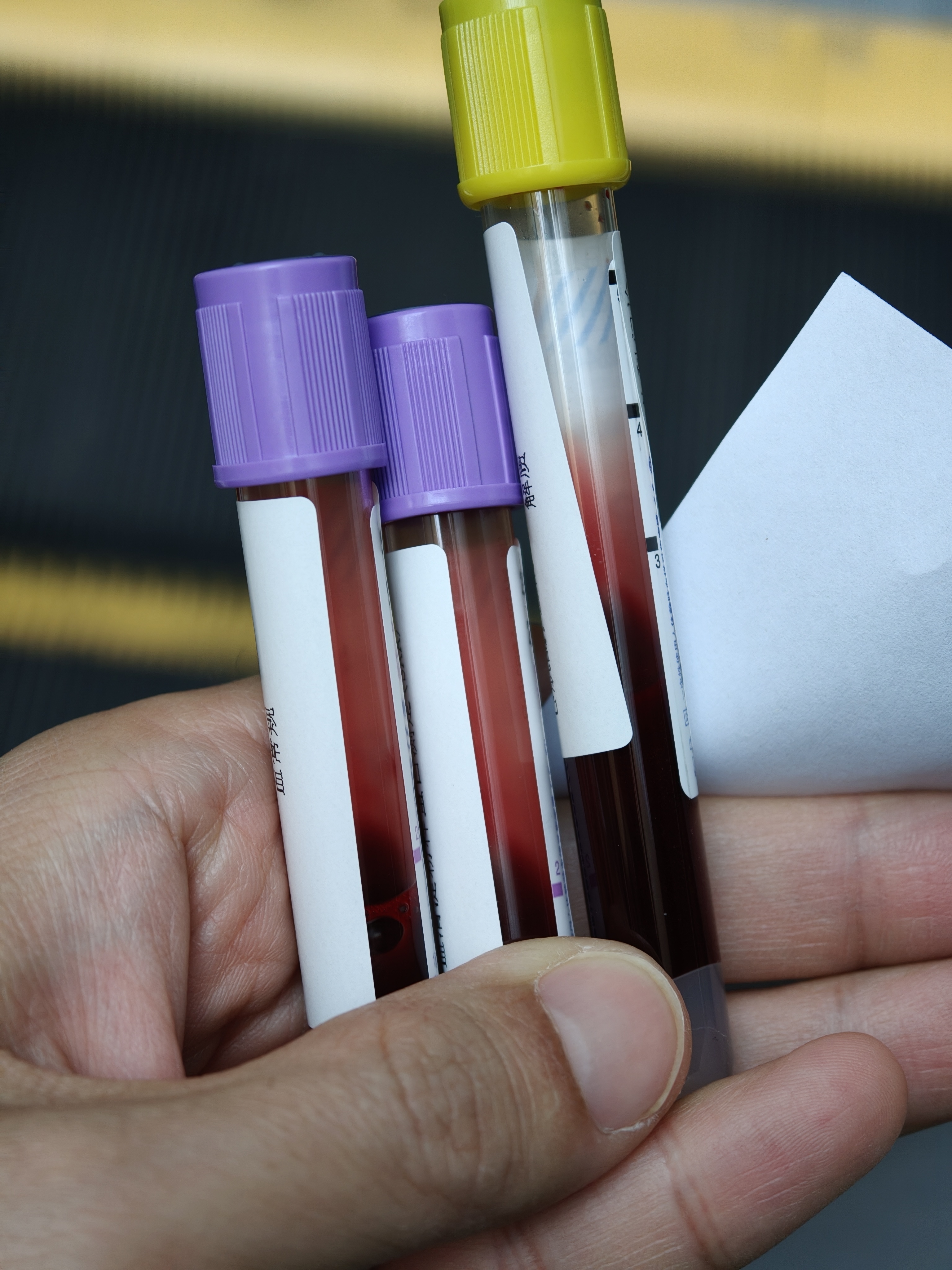 带小朋友来医院放个血 