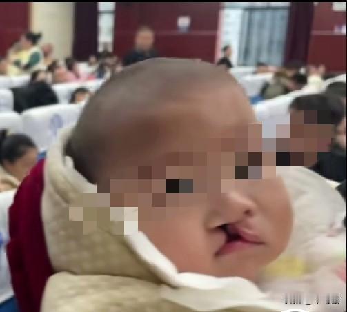 因为自己的女儿有先天性唇腭裂，于是李亚鹏发起了嫣然天使儿童医院，让更多的唇腭裂患