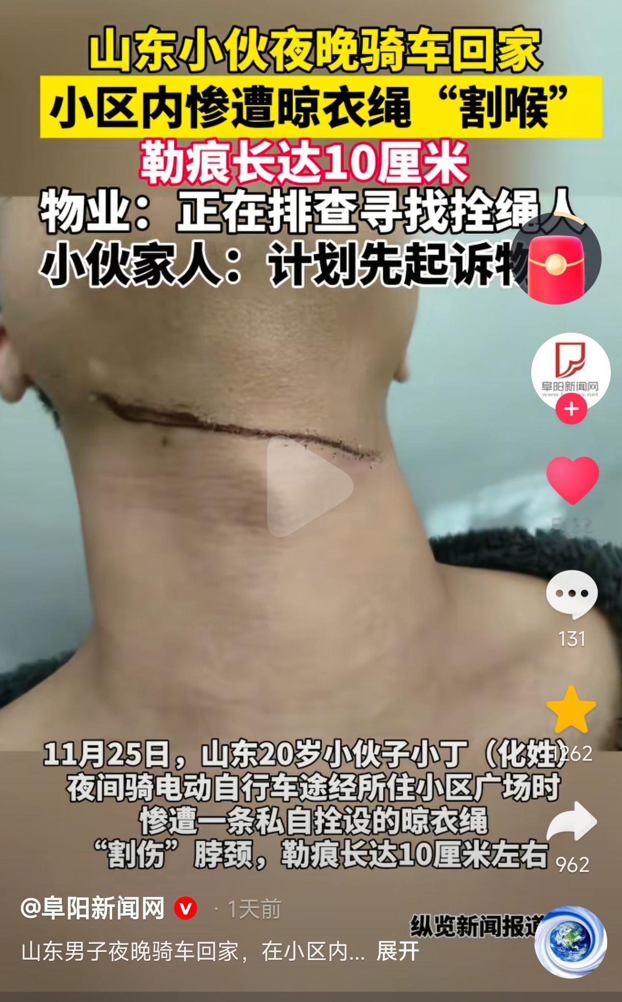 “又现夺命晾衣绳！”小伙晚上骑电瓶车回家时，被小区里私拴的一条晾衣绳“割喉”，伤