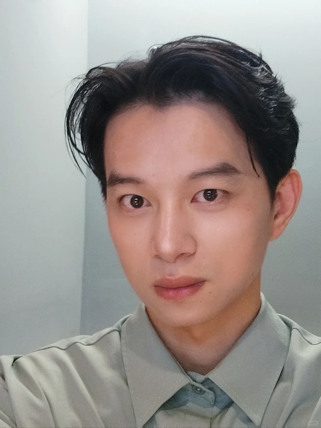 没医美，一年后法令纹减轻，眼角提升