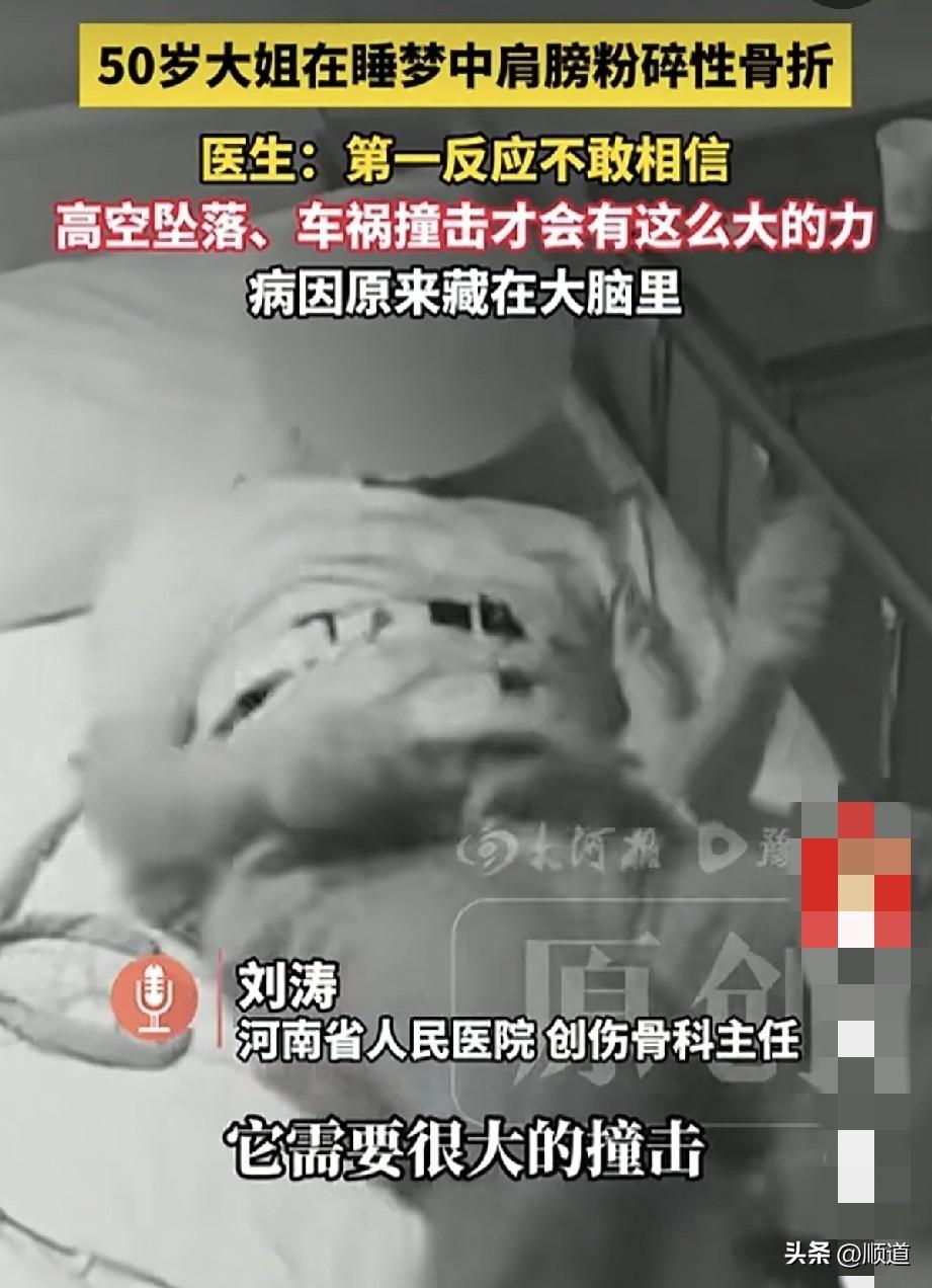 河南50岁大姐睡梦中肩部骨折碗成七八块，原来大姐是癫痫发作，剧烈抽动造成的。
看