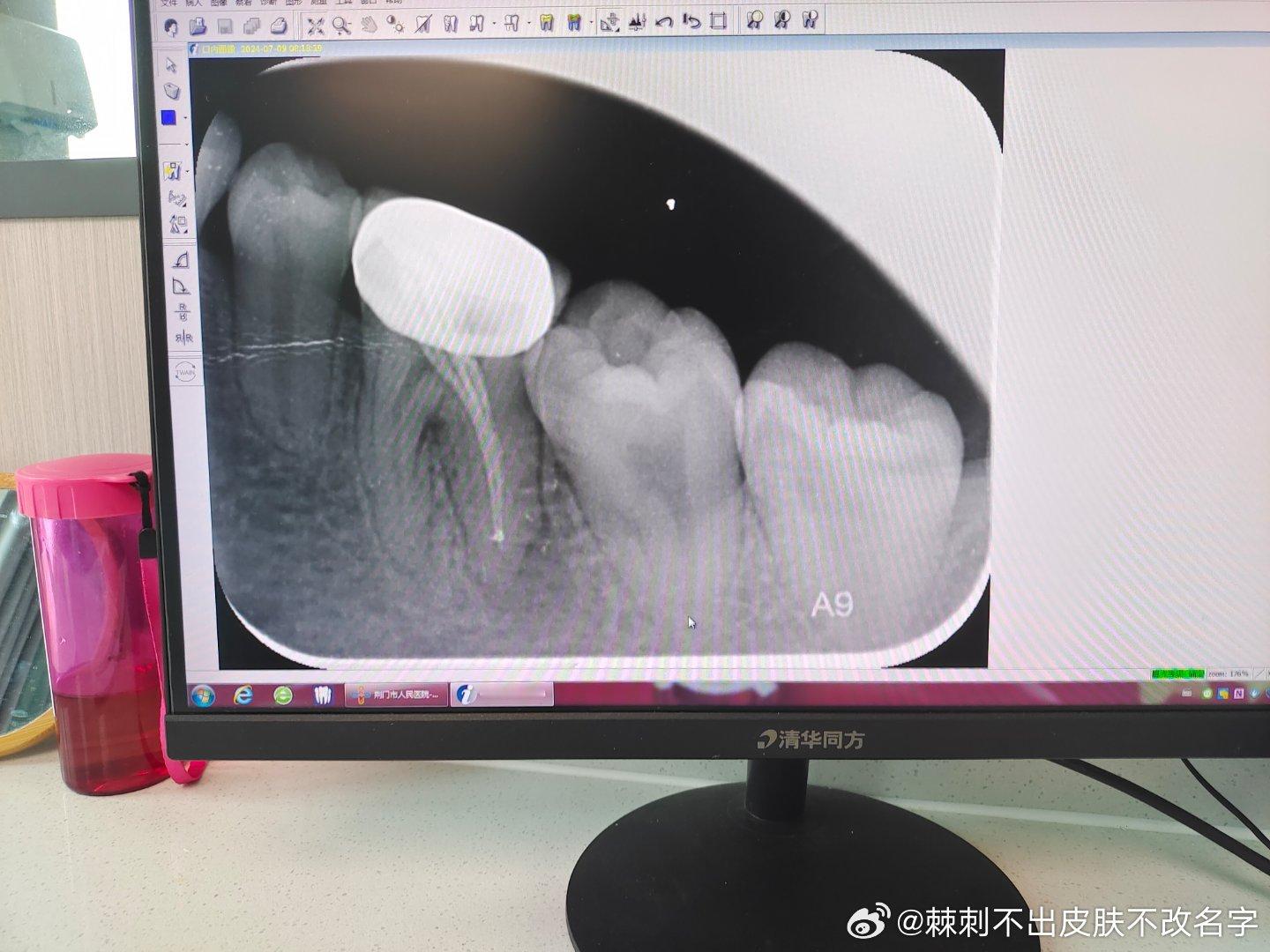痛的我真想撞墙[泪][泪] ​​​