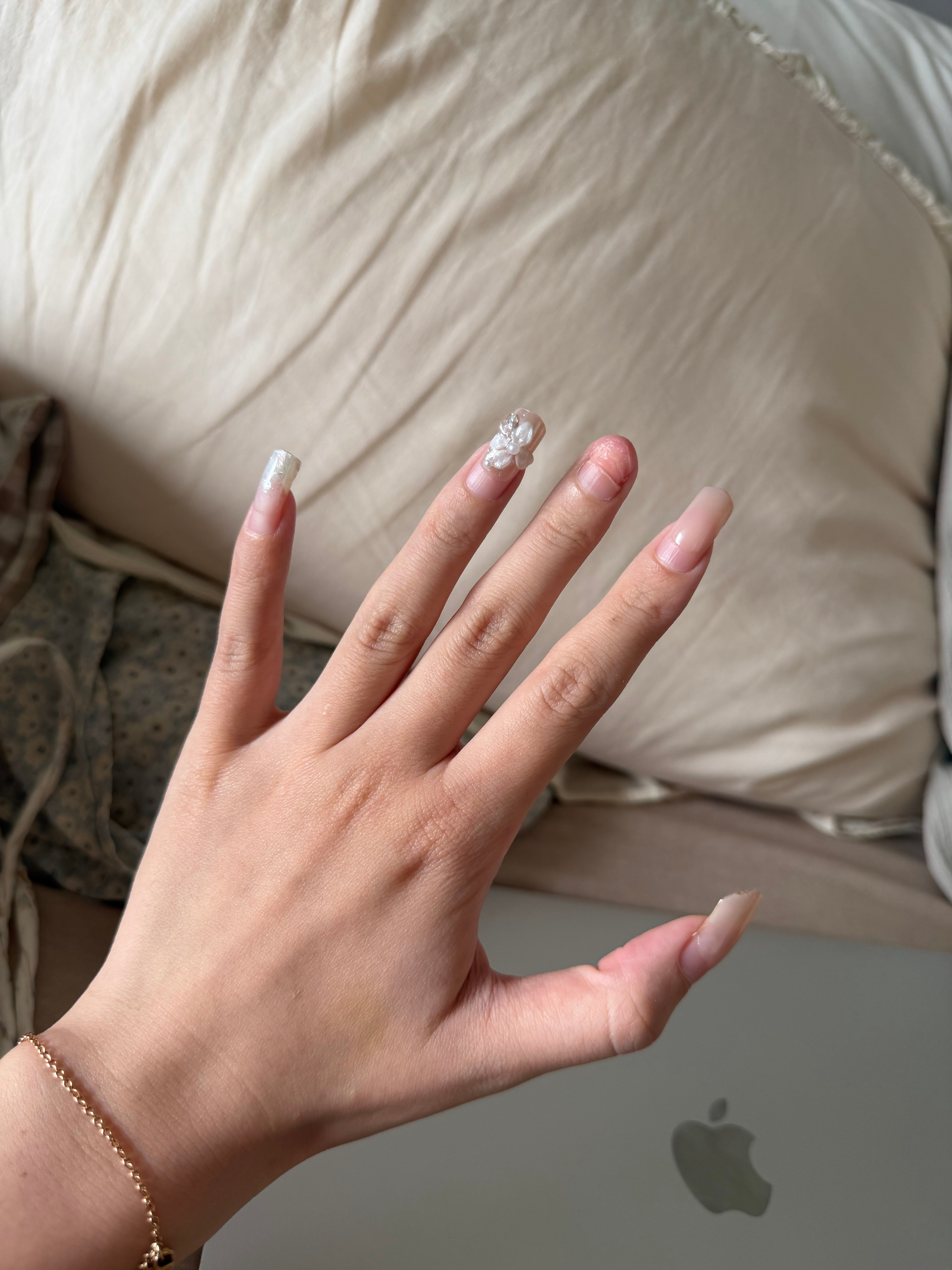 我的手最近是这个样子宝宝们指甲长了一个月左右一定一定要剪！别跟我一样带有侥幸心理