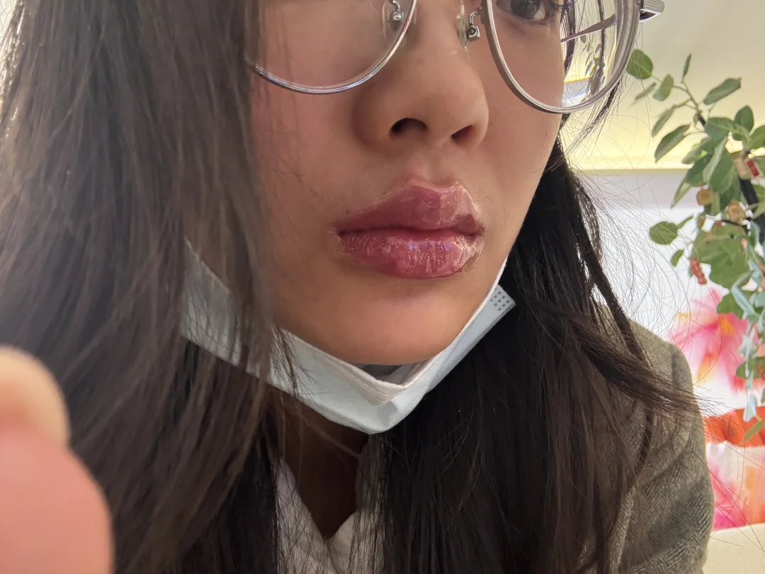 记录一下第一次biu嘴👄吧