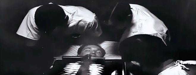 男子为了让自己雄起，4年连续喝了1401瓶镭辐射水，结果下巴被溶解，骨骼也被融化