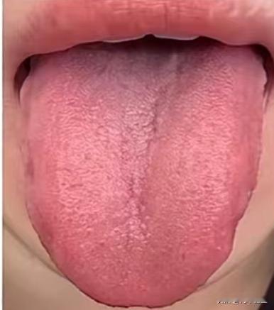 这种事自己乱来可不行，时间越长越难调理

最近一粉丝问我说，一直没有女朋友，自己