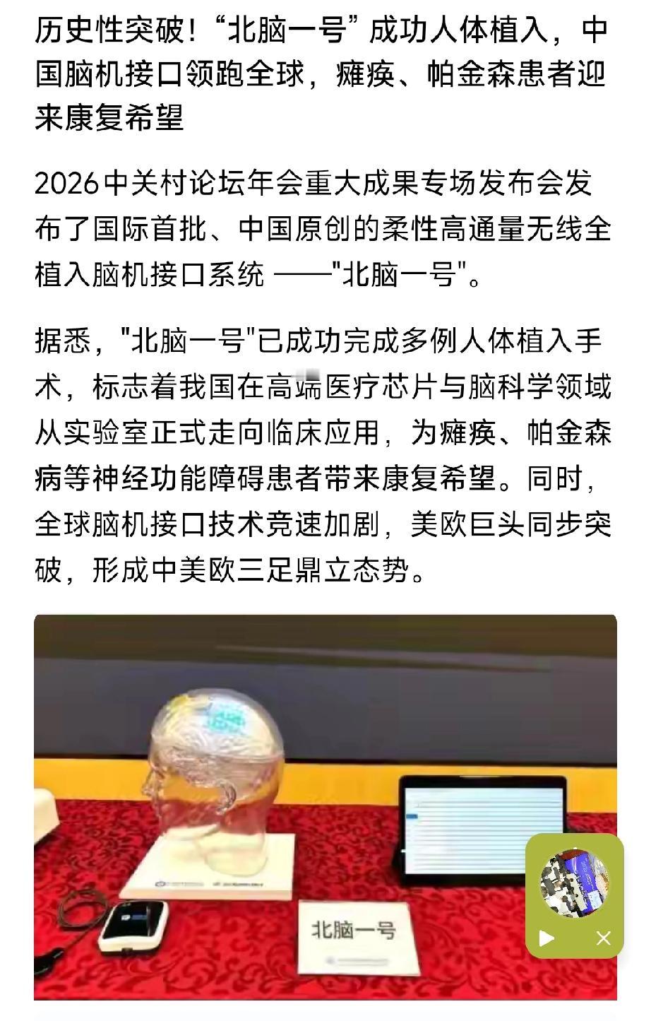 炸裂里程碑！北脑一号人体植入落地，中国脑机接口弯道超车领跑全球
 
2026中关