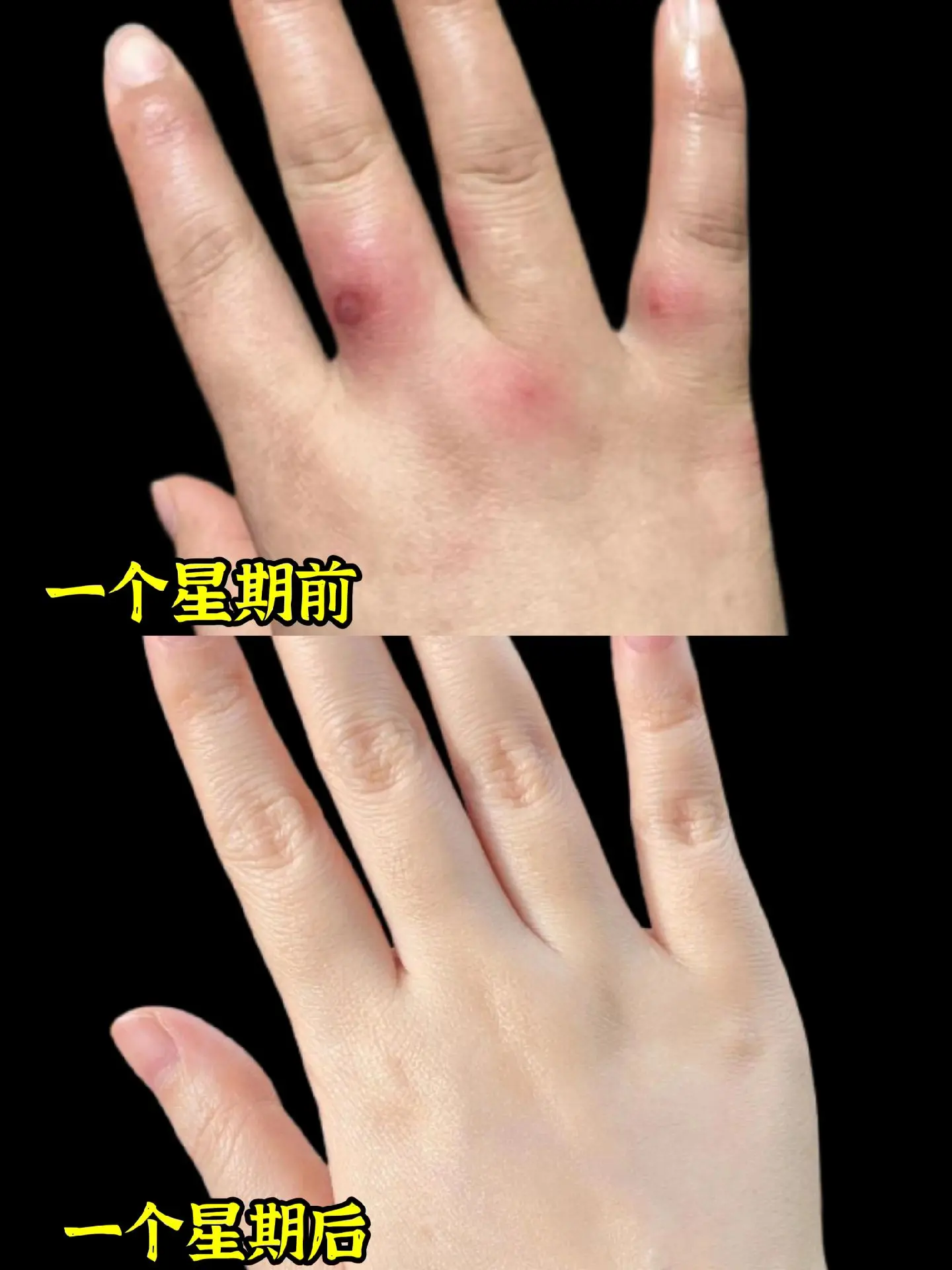 谁还没用过这个红花冻裂蛇油膏！我都会伤心，一到秋冬就容易冻手，还好闺蜜...