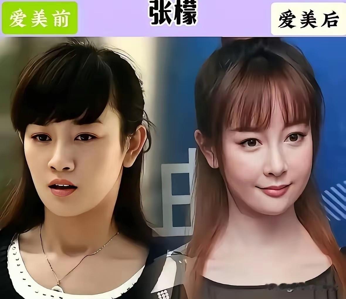娱乐圈不少女明星天生样貌出众，却盲目跟风医美，最后反倒丢失辨识度、颜值大跌，实在