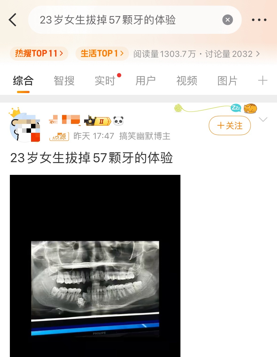 有些人的种种行为真是让人忍不住联想，看到这个23岁女生拔牙，就想到某个女明星，当