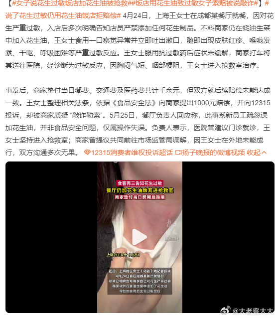 女子说花生过敏饭店加花生油被抢救花生过敏是很厉害的不死顽疾，美国人很常见，中国人