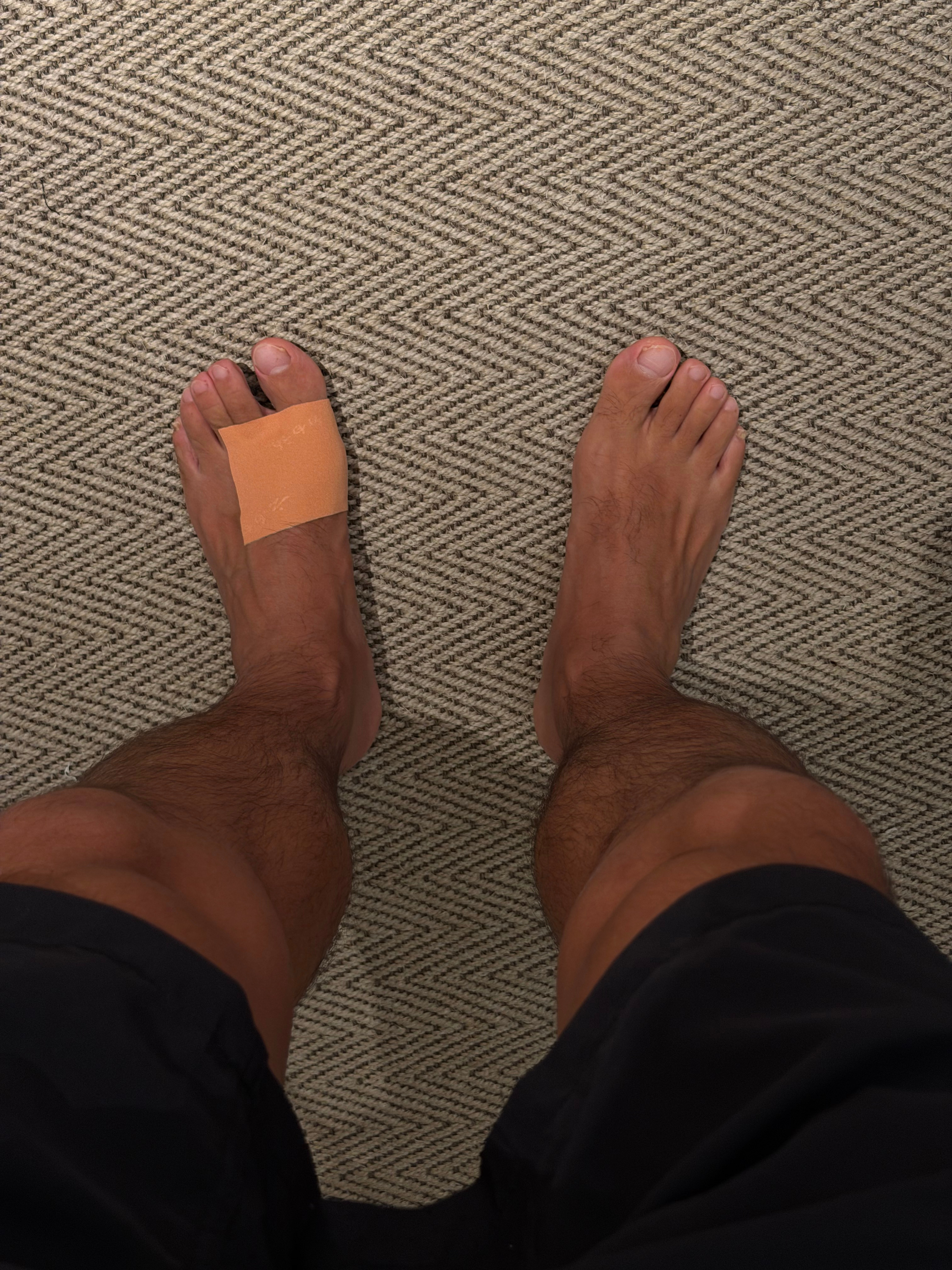 不小心崴到了脚  ​​​