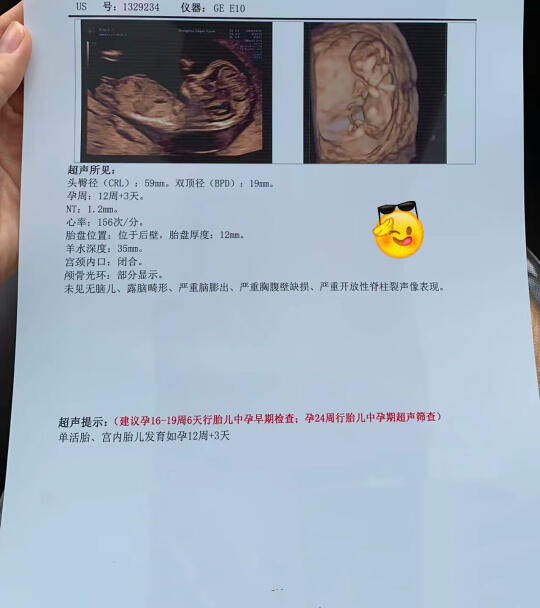 我怀上啦~听说好孕会传染哟~✌️