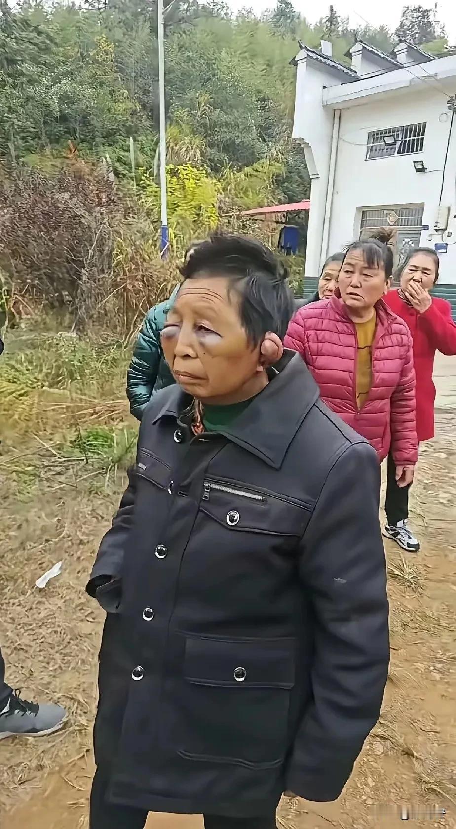 湖南平江家暴后续：75岁施暴者陈某明被抓！可刘大妈的遭遇，让人心疼。12月2号到