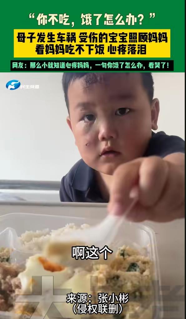 让全网落泪的小男孩后续来了！

“你不吃，饿了怎么办？”
男孩脸上满是受伤后的结