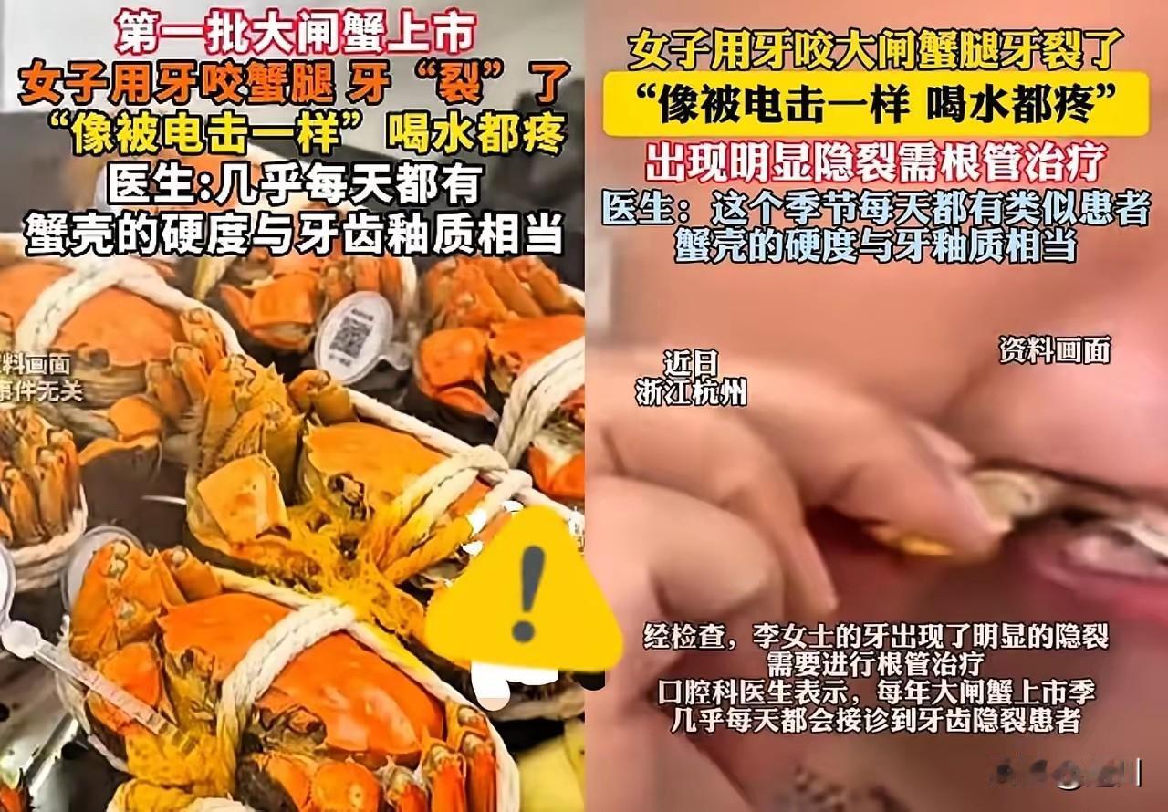 第一批大闸蟹上市，女子用牙咬，被崩坏

小编发现，近期国庆节，女子买了大闸蟹，想