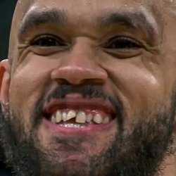 ▲这牙看起来挺难绷