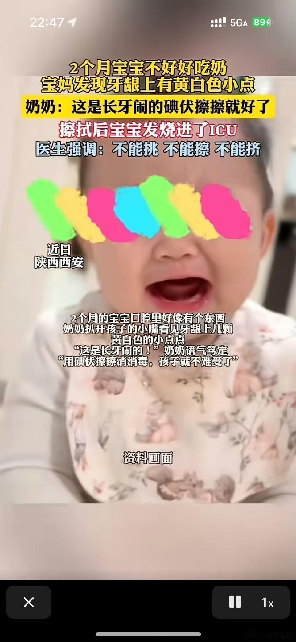 揪心！西安2个月宝宝被奶奶用碘伏擦牙龈进ICU，医生紧急提醒
 
近日陕西西安，