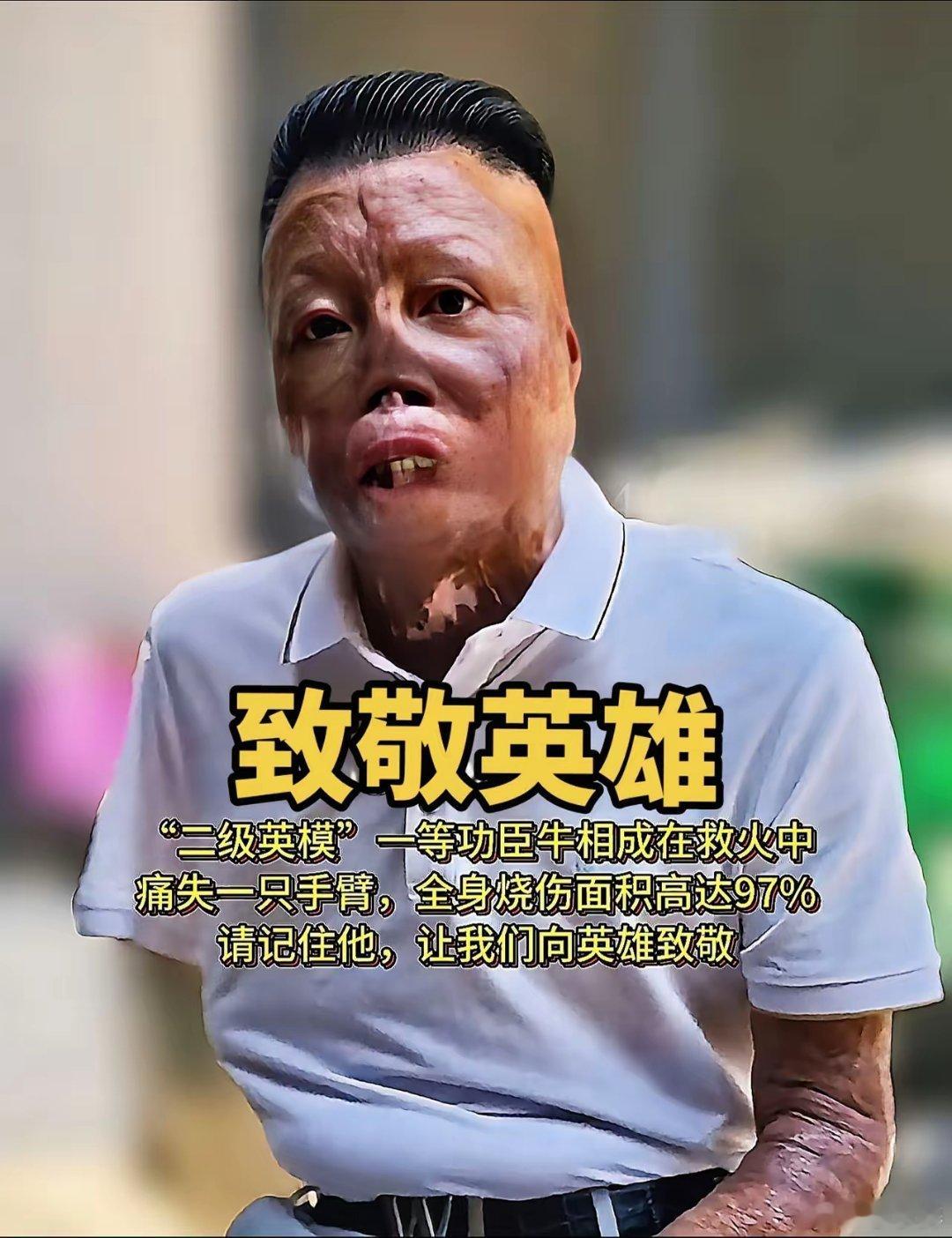 这样的面容你怕吗？致敬消防英雄牛相成!（转） 