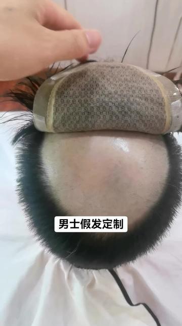 男士假发定制
📍北海 永赞工作室
坚持做一件事，你会发现，时间会给你答案。加油