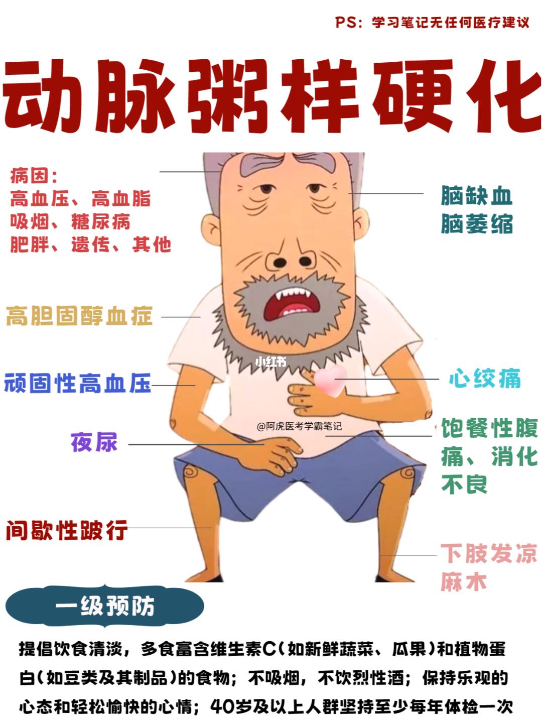 阿虎医考学霸笔记：当牛爷爷动脉粥样硬化