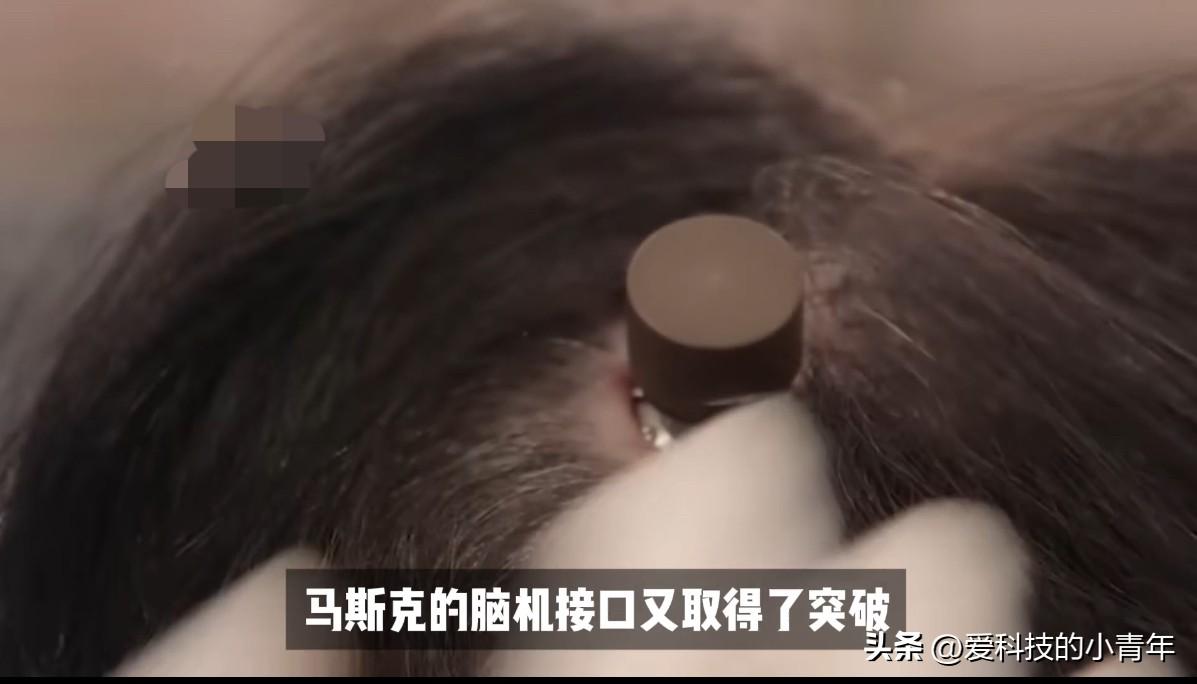 科幻即将成为现实！
马斯克，脑机接口，大动作！
也许未来，都不用在上学学知识了，